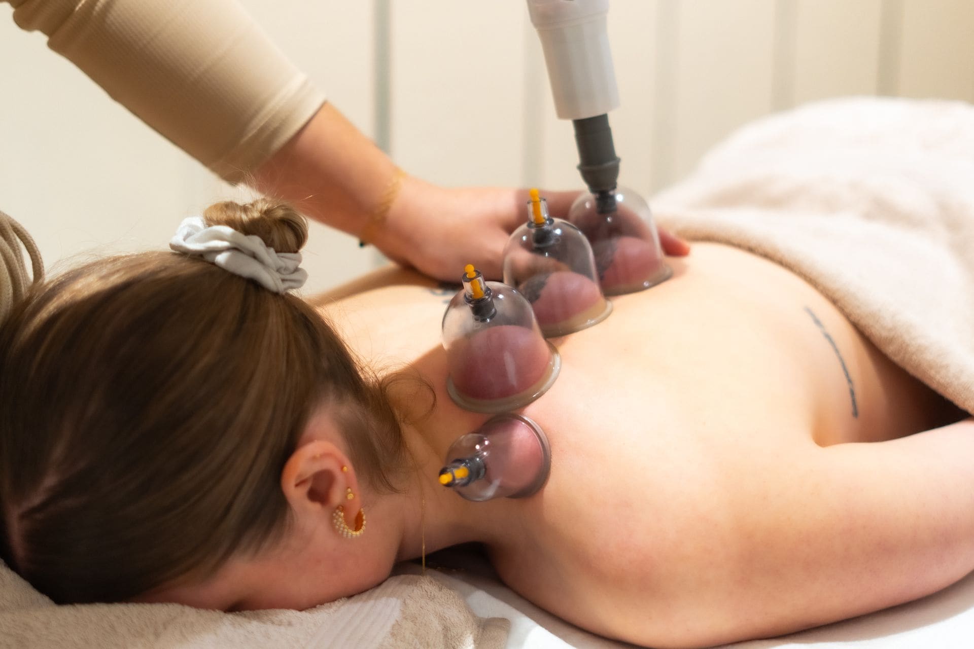Cuppingglazen op de rug tijdens een behandeling.